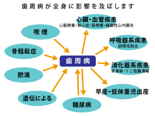 歯周病による合併症 歯周病による合併症
