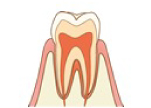 健康な状態の歯とは